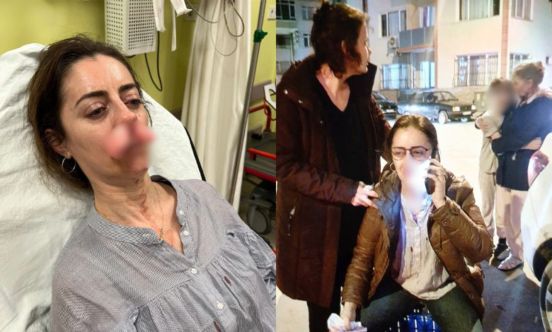 Kocasına benzettiği adamın eşine saldırdı