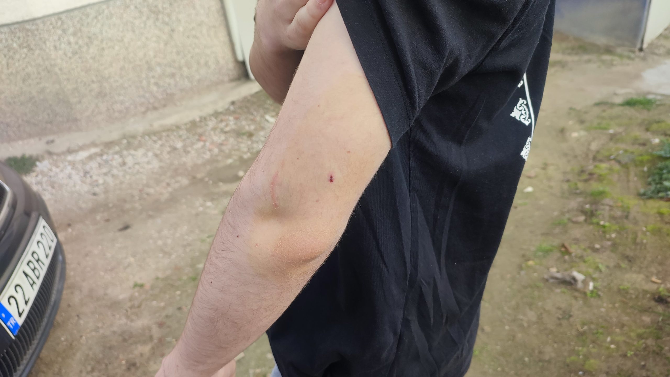 Okula giden öğrenciye köpek saldırdı