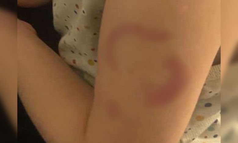 Edirne’de gündüz bakımevinde şok iddia!